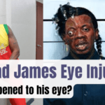 Trinidad James Eye Injury-What happened to his eye?