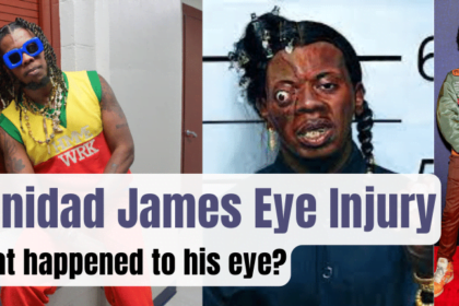 Trinidad James Eye Injury-What happened to his eye?